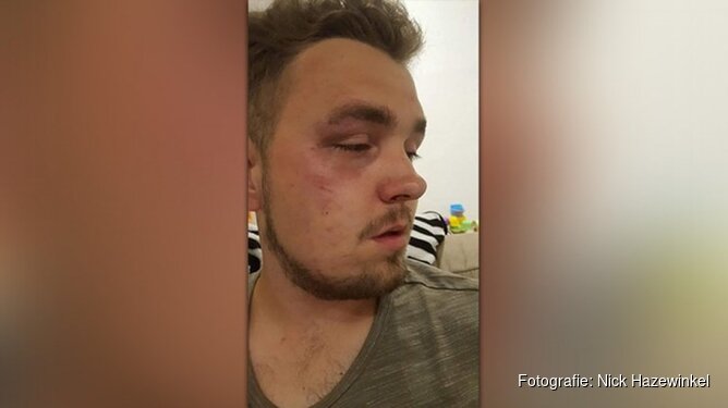 Mishandelde man uit Noord-Scharwoude na dagen ontslagen uit ziekenhuis