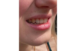 Nieuw bij Kingdom Tattoo & Piercing Alkmaar: Toothgems