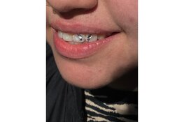 Nieuw bij Kingdom Tattoo & Piercing Alkmaar: Toothgems